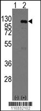 Anti-CASC3 Rabbit Polyclonal Antibody