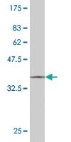 Anti-STYK1 Mouse Monoclonal Antibody [clone: 4A4]