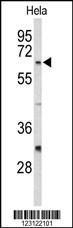 Anti-CDC20 Rabbit Polyclonal Antibody (AP (Alkaline Phosphatase))