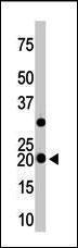 Anti-HPCAL1 Rabbit Polyclonal Antibody (AP (Alkaline Phosphatase))