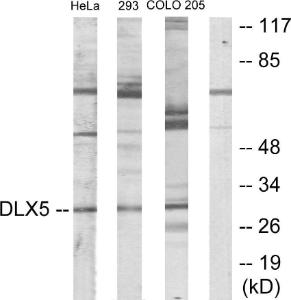 Western blot analysis of lysates from HeLa, 293, and COLO205 cells using Anti-DLX5 Antibody. The right hand lane represents a negative control, where the antibody is blocked by the immunising peptide