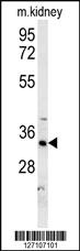 Anti-DHB13 Rabbit Polyclonal Antibody