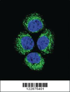 Anti-GLS Rabbit Polyclonal Antibody