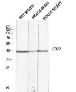 Western blot analysis of rat spleen mouse brain mouse spleen lysis using Anti-CD72 Antibody