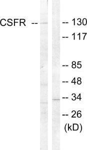 Antibody anti-CSFR 100 µg