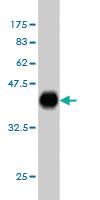 Anti-PAX2 Mouse Monoclonal Antibody [clone: 3C7]