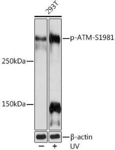 Western blot analysis of extracts of 293T cells, using Anti-ATM (phospho Ser1981) Antibody [ARC1575] (A305716) at 1:1000 dilution