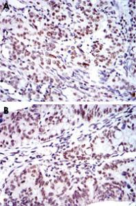 Anti-BMI1 Mouse Monoclonal Antibody [clone: 3E3]