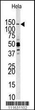 Anti-PI3CKG Rabbit Polyclonal Antibody (FITC (Fluorescein))