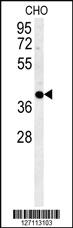 Anti-CCYL1 Rabbit Polyclonal Antibody