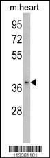 Anti-FBP2 Rabbit polyclonal antibody