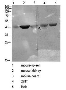 Western blot analysis of various cells using Anti-CD72 Antibody