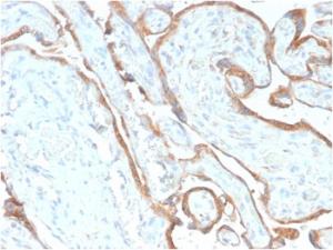 Anti-EGFR Rabbit Recombinant Antibody [clone: GFR/2968R]