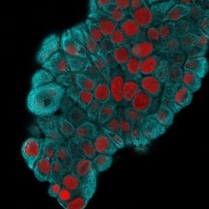 Immunofluorescent analysis of methanol fixed MCF-7 Cells stained with Anti-Cytokeratin 19 Antibody [KRT19/800] followed by Goat Anti-Mouse IgG (CF&#174; 488) (Cyan). Nuclei are stained with RedDot.