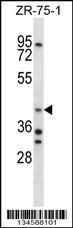 Anti-AIP Rabbit Polyclonal Antibody (HRP (Horseradish Peroxidase))