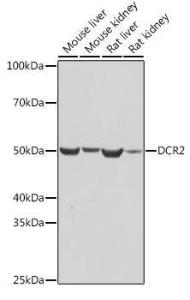 Western blot analysis of extracts of various cell lines, using Anti-DcR2 Antibody [ARC2052] (A308265) at 1:1,000 dilution. The secondary antibody was Goat Anti-Rabbit IgG H&L Antibody (HRP) at 1:10,000 dilution.