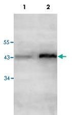 Anti-ACAA1 Rabbit Polyclonal Antibody