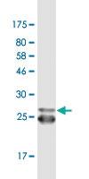 Anti-HTR2B Mouse Monoclonal Antibody [clone: 4A4]