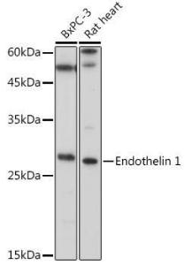 Western blot analysis of extracts of various cell lines, using Anti-Endothelin 1 Antibody (A12679) at 1:1,000 dilution. The secondary antibody was Goat Anti-Rabbit IgG H&L Antibody (HRP) at 1:10,000 dilution.