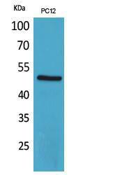 Western blot analysis of extracts from PC12 cells using Anti-CRHR1 Antibody