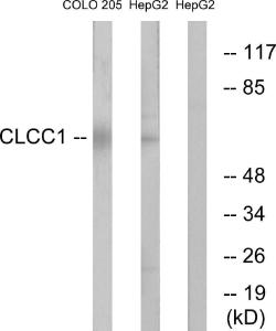 Western blot analysis of lysates from COLO and HepG2 cells using Anti-CLCC1 Antibody. The right hand lane represents a negative control, where the antibody is blocked by the immunising peptide