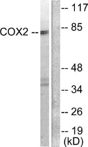 Western blot analysis of lysates from A549 cells using Anti-Cox2 Antibody. The right hand lane represents a negative control, where the antibody is blocked by the immunising peptide.