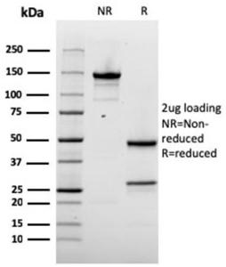 SDS-PAGE analysis of Anti-NAPSIN A Antibody [rNAPSA/1239] under non-reduced and reduced conditions; showing intact IgG and intact heavy and light chains, respectively SDS-PAGE analysis confirms the integrity and purity of the antibody