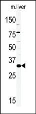 Anti-PTH Rabbit Polyclonal Antibody