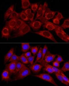 Immunofluorescence analysis of NIH/3T3 cells using Anti-Endothelin 1 Antibody (A12679) at a dilution of 1:50 (40x lens). DAPI was used to stain the cell nuclei (blue).