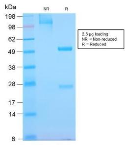 Anti-EGFR Rabbit Recombinant Antibody [clone: GFR/2968R]