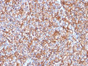 Anti-beta III Spectrin antibody