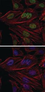 Anti-BMI1 Mouse Monoclonal Antibody [clone: 3E3]