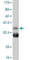 Anti-TBX18 Mouse Monoclonal Antibody [clone: 3C12]