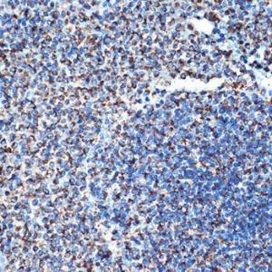 Immunohistochemistry analysis of paraffin-embedded rat spleen using Anti-DcR2 Antibody [ARC2052] (A308265) at a dilution of 1:100 (40x lens). Perform microwave antigen retrieval with 10 mM Tris/EDTA buffer pH 9.0 before commencing with IHC staining protocol.