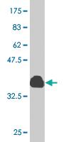 Anti-OTOP2 Mouse Monoclonal Antibody [clone: 6F11]