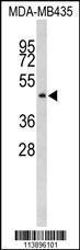 Anti-ILK Rabbit Polyclonal Antibody (AP (Alkaline Phosphatase))