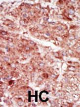 Anti-Hexokinase 3 Rabbit Polyclonal Antibody (AP (Alkaline Phosphatase))