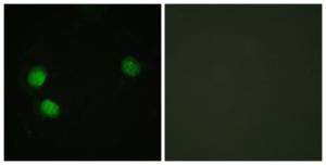 Immunofluorescence analysis of HeLa cells using Anti-Bloom Syndrome (phospho Thr99) Antibody. The right hand panel represents a negative control, where the Antibody was pre-incubated with the immunising peptide