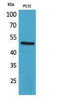 Western blot analysis of PC12 cells using Anti-CRHR1 Antibody