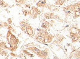 Anti-ACAA1 Rabbit Polyclonal Antibody