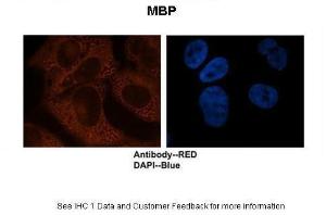 Anti-MBP Rabbit Polyclonal Antibody