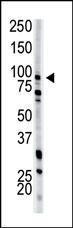 Anti-PFKM Rabbit Polyclonal Antibody (APC (Allophycocyanin))