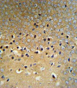 Anti-VHL Rabbit Polyclonal Antibody (AP (Alkaline Phosphatase))