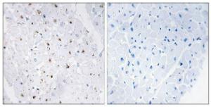 Immunohistochemical analysis of paraffin-embedded human heart using Anti-Bloom Syndrome (phospho Thr99) Antibody. The right hand panel represents a negative control, where the Antibody was pre-incubated with the immunising peptide