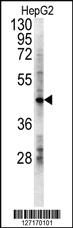 Anti-LDHD Rabbit Polyclonal Antibody