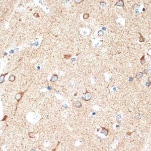 Immunohistochemistry analysis of paraffin-embedded human brain tissue using Anti-DcR2 Antibody [ARC2052] (A308265) at a dilution of 1:100 (40x lens). Perform microwave antigen retrieval with 10 mM Tris/EDTA buffer pH 9.0 before commencing with IHC staining protocol.