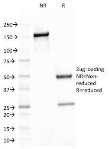 Anti-beta III Spectrin antibody