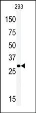 Anti-HBG1 Rabbit Polyclonal Antibody