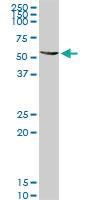 Anti-ALDH4A1 Rabbit Polyclonal Antibody