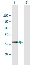 Anti-IFIT5 Mouse Polyclonal Antibody